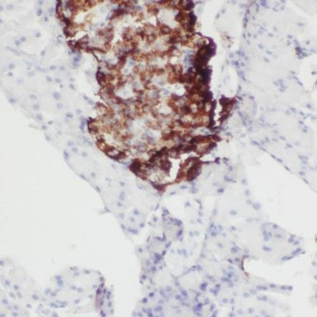 SLC25A23 Antibody