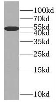 SLC25A25 Antibody