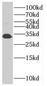 SLC25A45 Rabbit Polyclonal Antibody