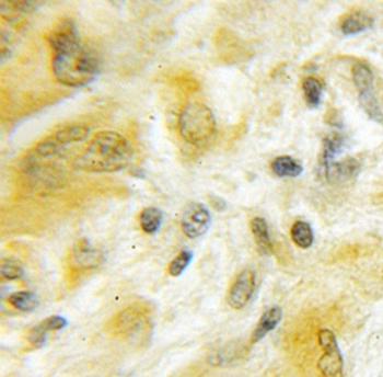 SLC25A46 Antibody