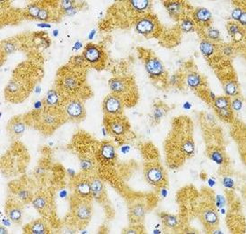 SLC27A2 Antibody