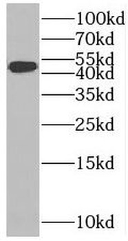 SLC37A4 Antibody