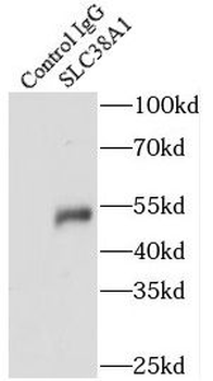 SLC38A1 Antibody