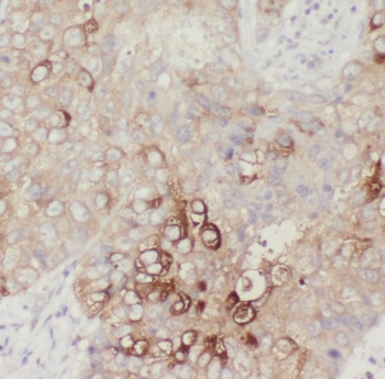 SLC38A3 Antibody