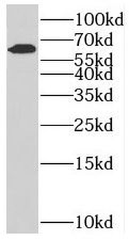 SLC38A4 Antibody