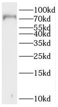 SLC5A3 Antibody