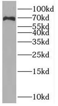 SLC6A8 Antibody