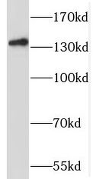 SLC9C2 Antibody
