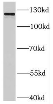 SLITRK3 Antibody