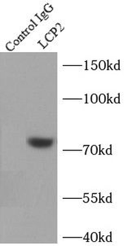 LCP2 Antibody