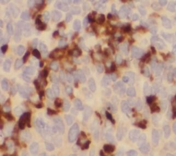LCP2 Antibody