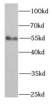 SMAD1 Rabbit Polyclonal Antibody