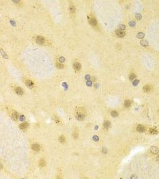 SMAD1 Rabbit Polyclonal Antibody