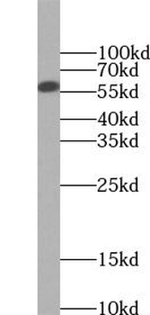 SMAD2 Rabbit Polyclonal Antibody