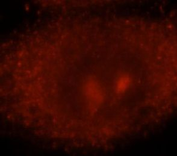 SMAD2 Rabbit Polyclonal Antibody