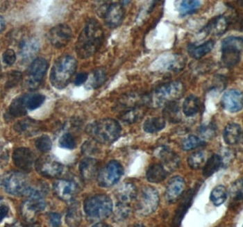 SMAD2 Rabbit Polyclonal Antibody