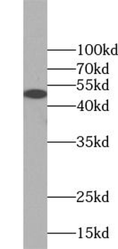 SMAD3 Rabbit Polyclonal Antibody
