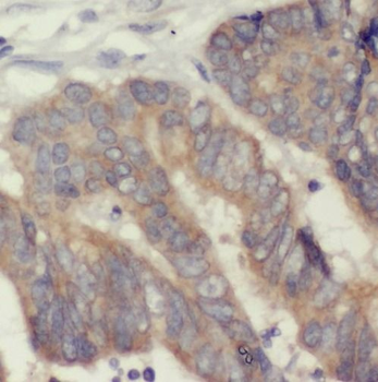 SMAD3 Rabbit Polyclonal Antibody