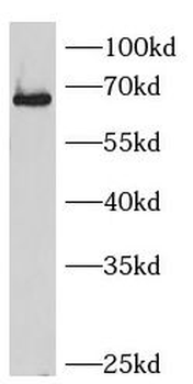 SMAD4 Rabbit Polyclonal Antibody