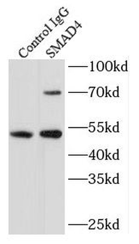 SMAD4 Rabbit Polyclonal Antibody