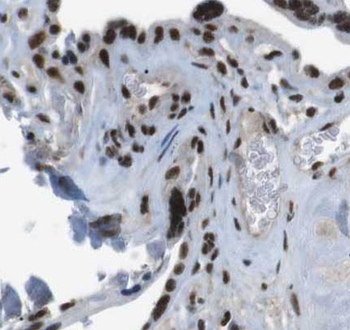 SMAD4 Rabbit Polyclonal Antibody