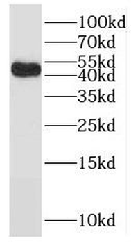 SMAD4 Rabbit Polyclonal Antibody
