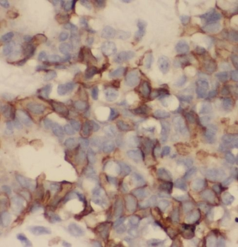 SMAD4 Rabbit Polyclonal Antibody
