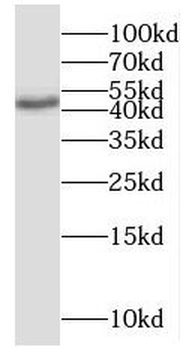 SMAD4 Rabbit Polyclonal Antibody