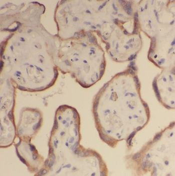 SMAD4 Rabbit Polyclonal Antibody