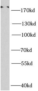 SMARCA4 Rabbit Polyclonal Antibody