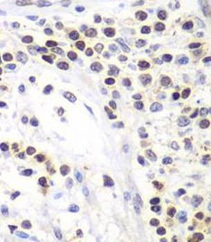 SMARCA4 Rabbit Polyclonal Antibody