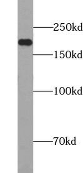 SMARCA4 Rabbit Polyclonal Antibody