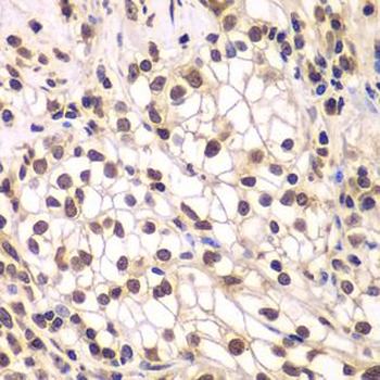 SMARCC1 Antibody