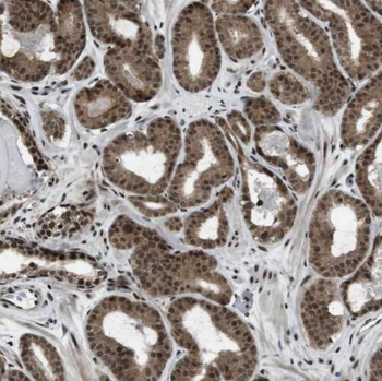 SMC4 Antibody