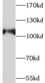 SMG5 Rabbit Polyclonal Antibody