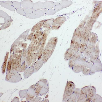 MYH11 Antibody