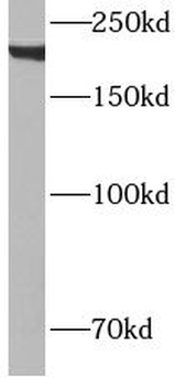 MYH11 Mouse Monoclonal Antibody