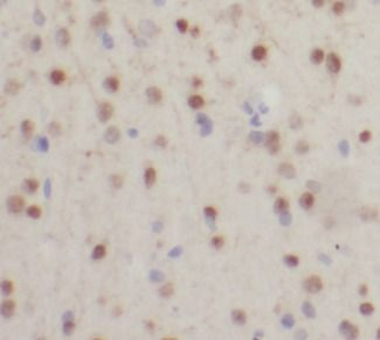 SMN1 Antibody