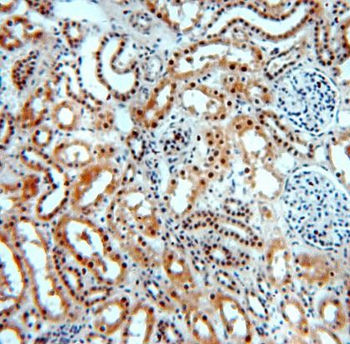 SMN1 Antibody