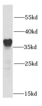 SMN1 Antibody