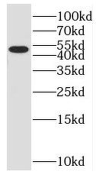 SMU1 Rabbit Polyclonal Antibody