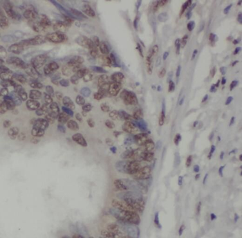 SMURF1 Antibody