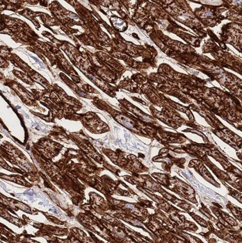 SMYD2 Antibody