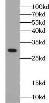 SNAI1 Rabbit Polyclonal Antibody
