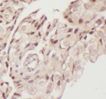 SNAI1 Rabbit Polyclonal Antibody