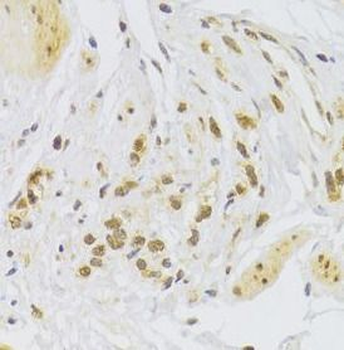 SNAI2 Antibody