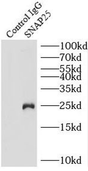 SNAP25 Antibody