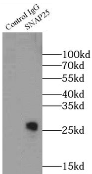 SNAP25 Antibody