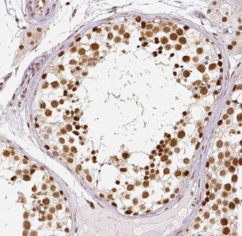 SNAPC5 Antibody