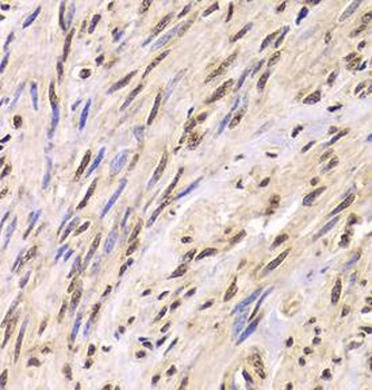 SNRPA Antibody